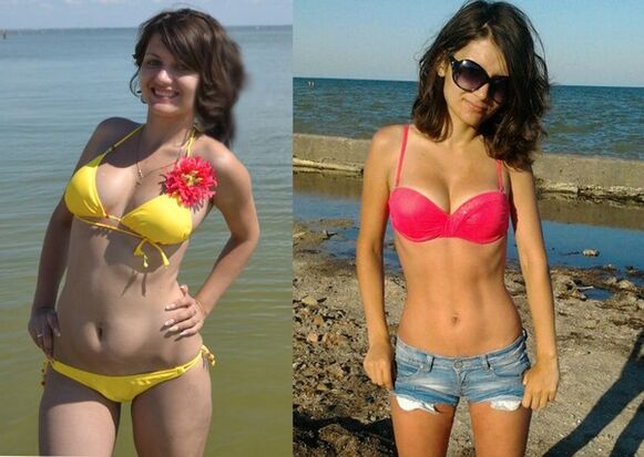 Anna lost 10 kg with NexaSlim